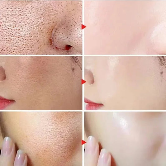 Vitamin C Tearing Mask Peel Off Facial Mask Oil Control Blackhead Remover Peel Off Dead Skin